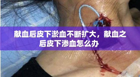 獻(xiàn)血后皮下淤血不斷擴(kuò)大，獻(xiàn)血之后皮下滲血怎么辦 