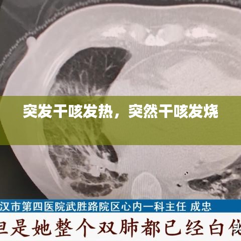 突發(fā)干咳發(fā)熱，突然干咳發(fā)燒 