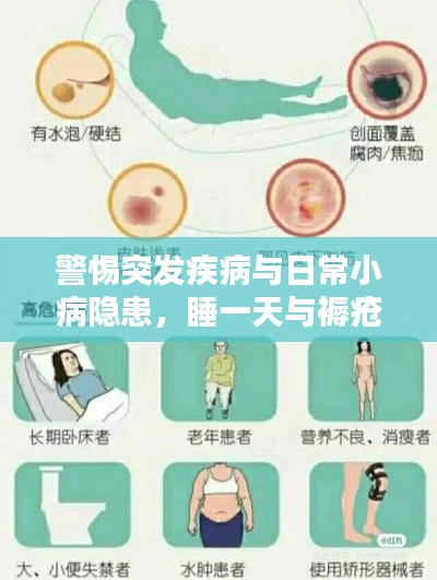 警惕突發(fā)疾病與日常小病隱患，睡一天與褥瘡的警示