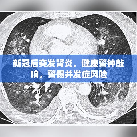新冠后突發(fā)腎炎，健康警鐘敲響，警惕并發(fā)癥風(fēng)險(xiǎn)