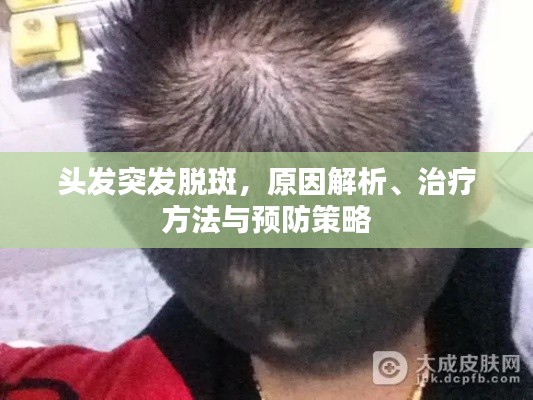 頭發(fā)突發(fā)脫斑，原因解析、治療方法與預(yù)防策略