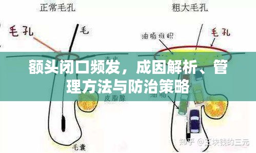 額頭閉口頻發(fā)，成因解析、管理方法與防治策略